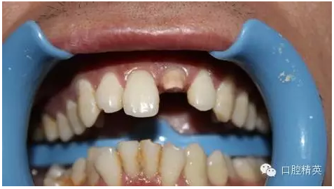 QQ圖片20150730112043.png QQ圖片20150730112043.png