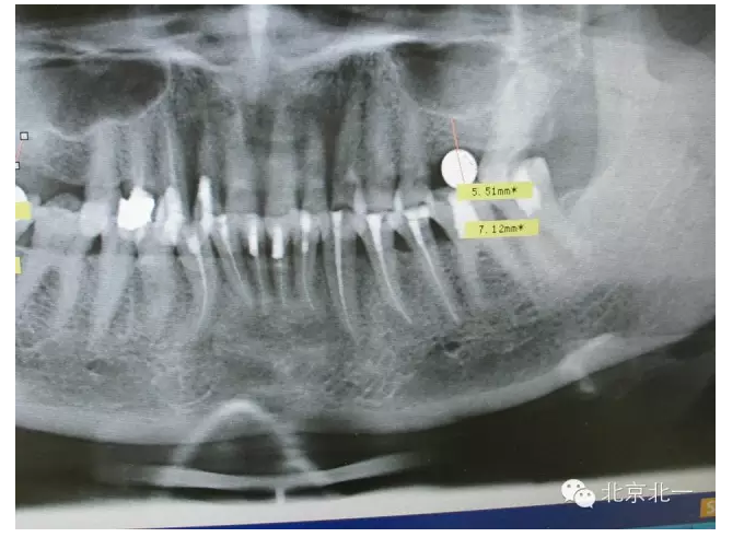 QQ圖片20150803111245.png QQ圖片20150803111245.png