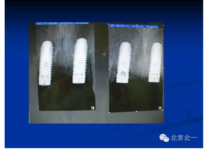 QQ圖片20150803111302.png QQ圖片20150803111302.png