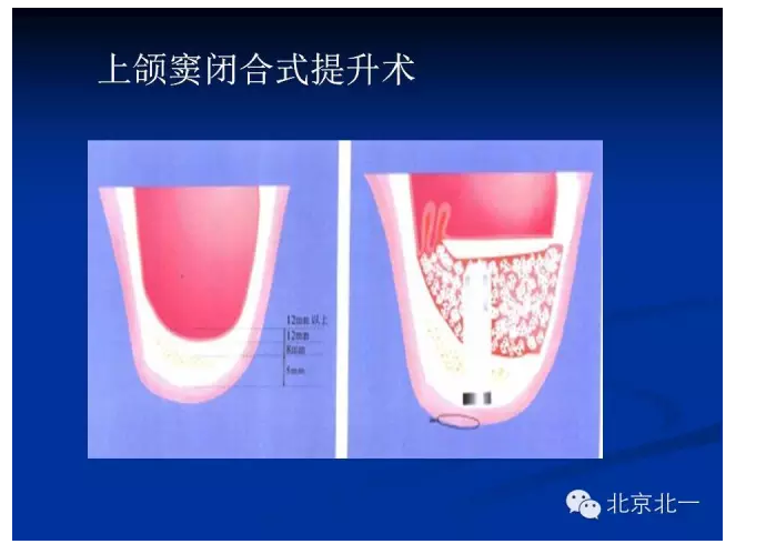 QQ圖片20150803112541.png QQ圖片20150803112541.png