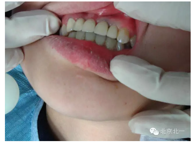 QQ圖片20150803113118.png QQ圖片20150803113118.png