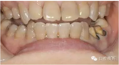 QQ圖片20150803105759.png QQ圖片20150803105759.png