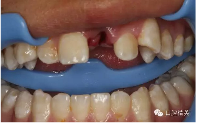 QQ圖片20150804105513.png QQ圖片20150804105513.png