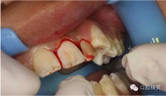 QQ圖片20150804110708.png QQ圖片20150804110708.png