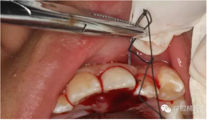 QQ圖片20150804110723.png QQ圖片20150804110723.png