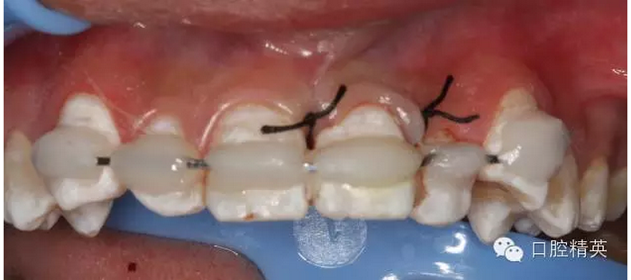 QQ圖片20150804110841.png QQ圖片20150804110841.png