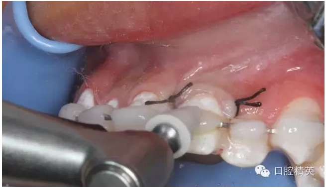 QQ圖片20150804110908.png QQ圖片20150804110908.png