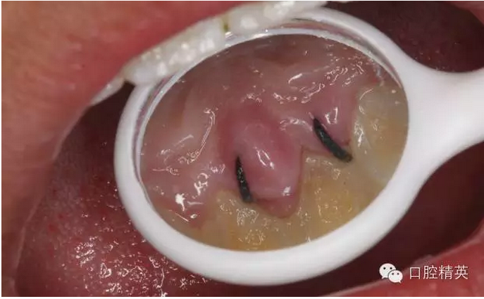 QQ圖片20150804110950.png QQ圖片20150804110950.png