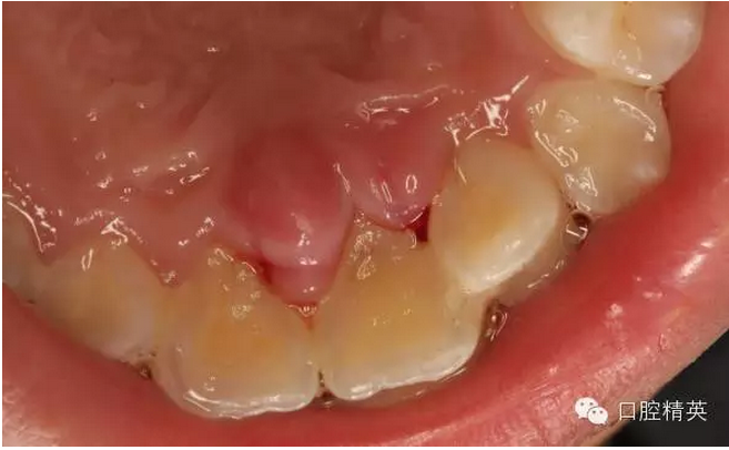 QQ圖片20150804111029.png QQ圖片20150804111029.png