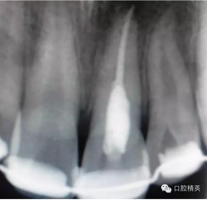 QQ圖片20150804111044.png QQ圖片20150804111044.png