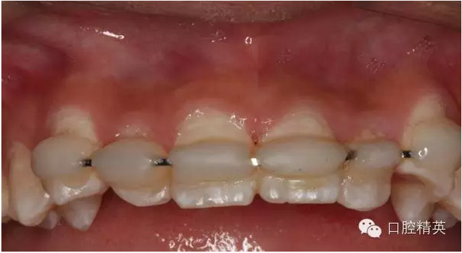 QQ圖片20150804111058.png QQ圖片20150804111058.png