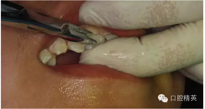 QQ圖片20150804111146.png QQ圖片20150804111146.png