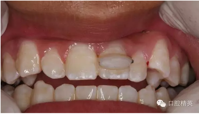 QQ圖片20150804111158.png QQ圖片20150804111158.png