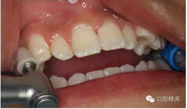 QQ圖片20150804112357.png QQ圖片20150804112357.png