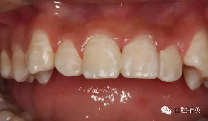 QQ圖片20150804112411.png QQ圖片20150804112411.png