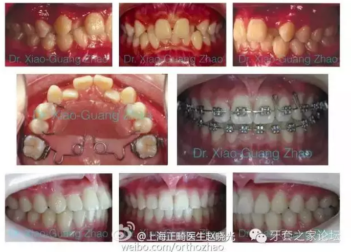 QQ圖片20150807105639.png QQ圖片20150807105639.png