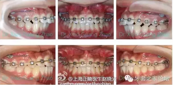 QQ圖片20150807105814.png QQ圖片20150807105814.png