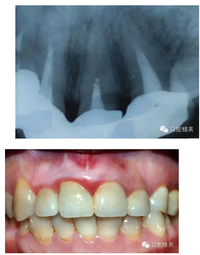 QQ圖片20150808142333.png QQ圖片20150808142333.png