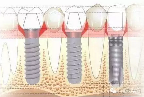 QQ圖片20150808173036.png QQ圖片20150808173036.png