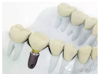 QQ圖片20150808173047.png QQ圖片20150808173047.png