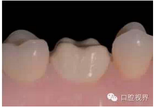 QQ圖片20150810092351.png QQ圖片20150810092351.png