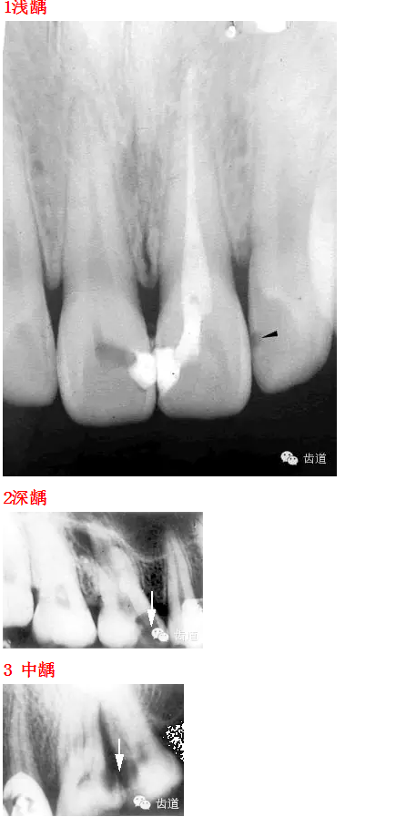 QQ圖片20150812095347.png QQ圖片20150812095347.png