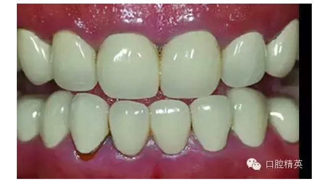 QQ圖片20150816095320.png QQ圖片20150816095320.png