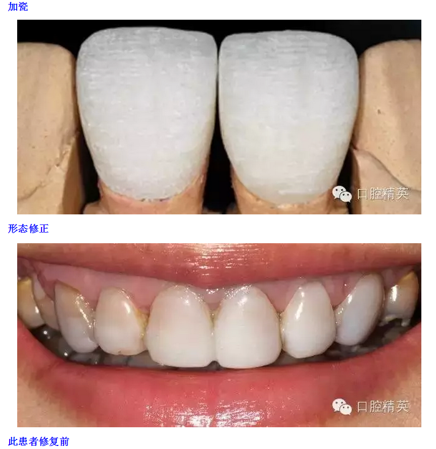 QQ圖片20150816095938.png QQ圖片20150816095938.png