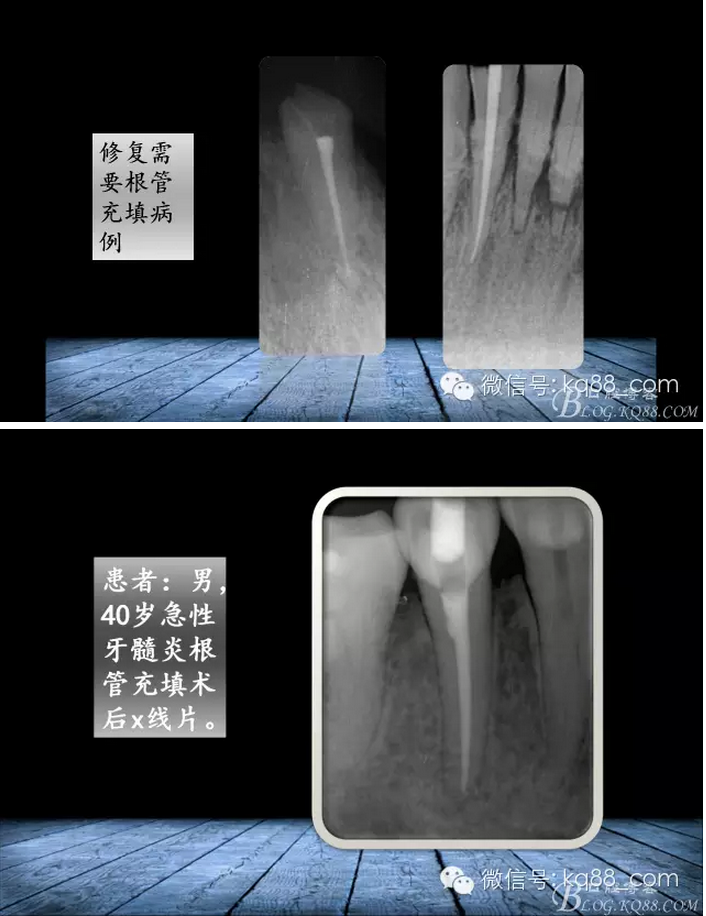 QQ圖片20150817140856.png QQ圖片20150817140856.png