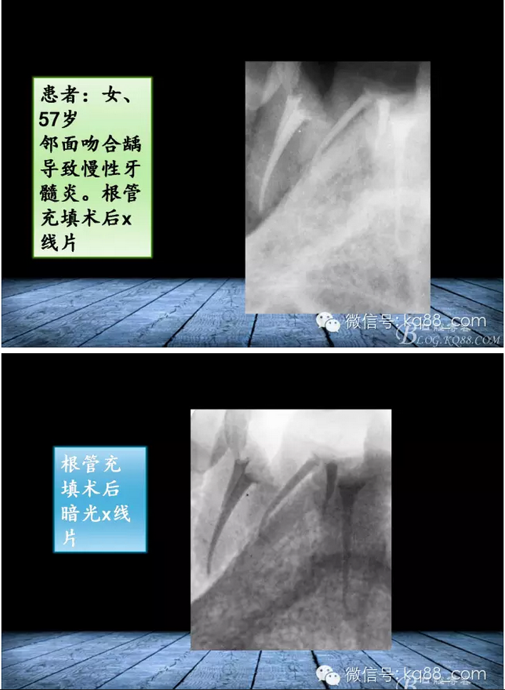 QQ圖片20150817140934.png QQ圖片20150817140934.png