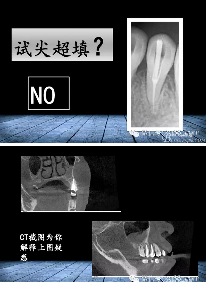 QQ圖片20150817141427.png QQ圖片20150817141427.png