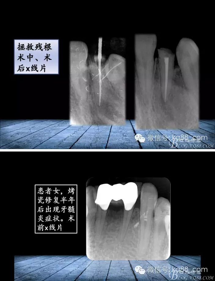 QQ圖片20150817141445.png QQ圖片20150817141445.png