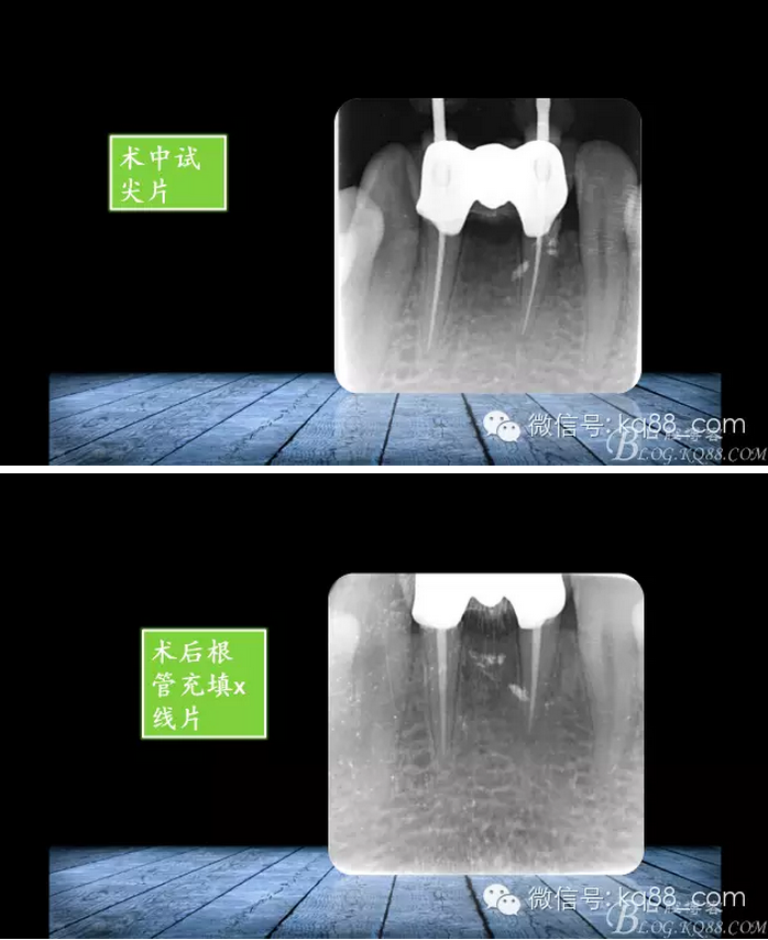 QQ圖片20150817141502.png QQ圖片20150817141502.png