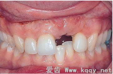 QQ圖片20150818102209.png QQ圖片20150818102209.png