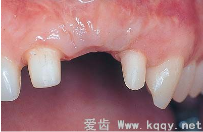 QQ圖片20150818102224.png QQ圖片20150818102224.png