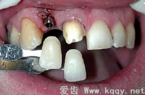 QQ圖片20150818102313.png QQ圖片20150818102313.png