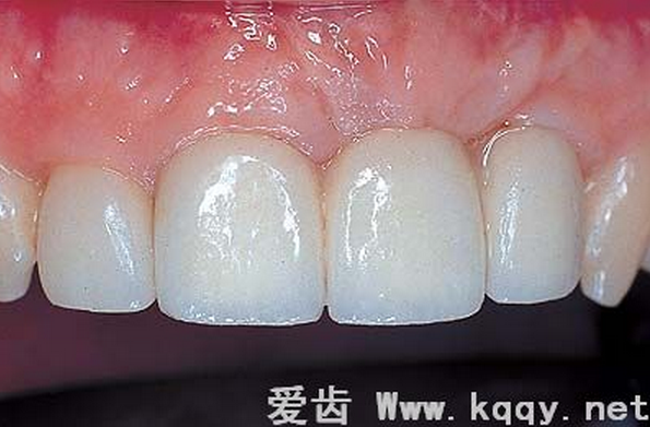 QQ圖片20150818102349.png QQ圖片20150818102349.png