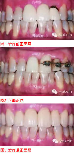 QQ圖片20150820101410.png QQ圖片20150820101410.png