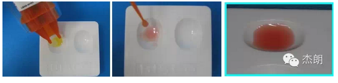 陳斌 DSD微笑設計 陳斌 DSD微笑設計