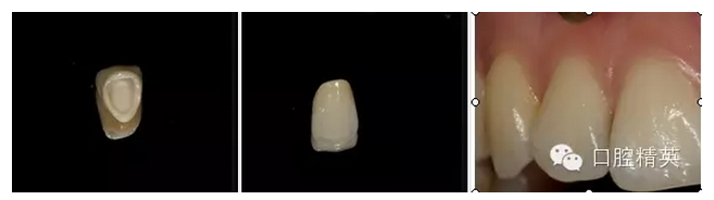 QQ圖片20150821093153.png QQ圖片20150821093153.png