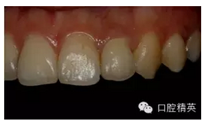 QQ圖片20150821093205.png QQ圖片20150821093205.png