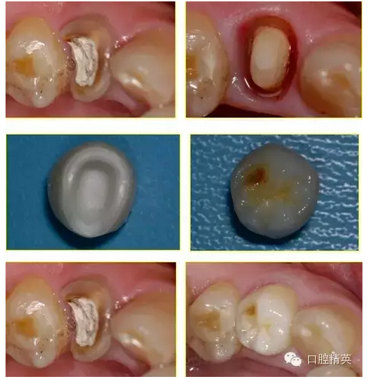 QQ圖片20150821093230.png QQ圖片20150821093230.png