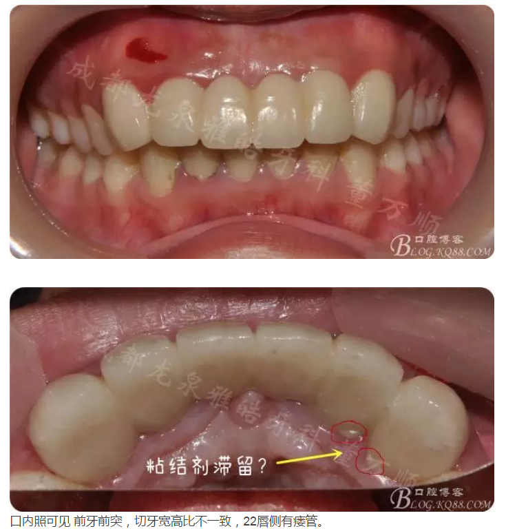 QQ圖片20150821095306.png QQ圖片20150821095306.png