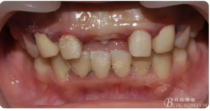 QQ圖片20150821095349.png QQ圖片20150821095349.png