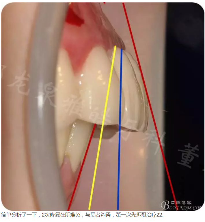 QQ圖片20150821095331.png QQ圖片20150821095331.png