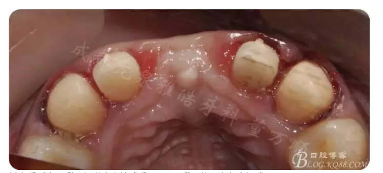 QQ圖片20150821095414.png QQ圖片20150821095414.png