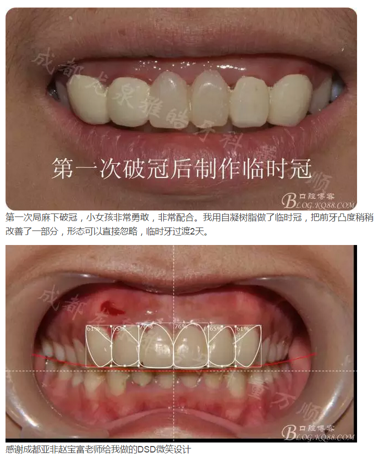 QQ圖片20150821095653.png QQ圖片20150821095653.png