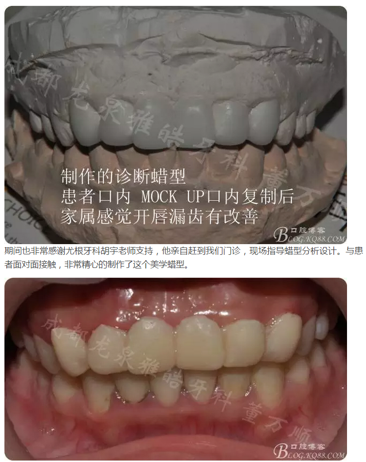 QQ圖片20150821095721.png QQ圖片20150821095721.png