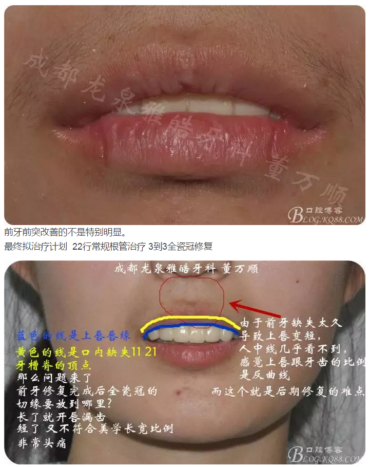 QQ圖片20150821095803.png QQ圖片20150821095803.png