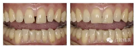 QQ圖片20150822144130.png QQ圖片20150822144130.png